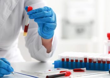 Teste de sangue pode detectar risco de morte por insuficiência cardíaca