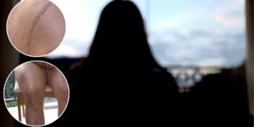 Mulher corre mais de 5 km em mata para fugir do ex em Santa Teresa